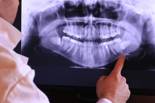 Best Emergency Treatment for Dental Infections or Abscesses in Toona, AL